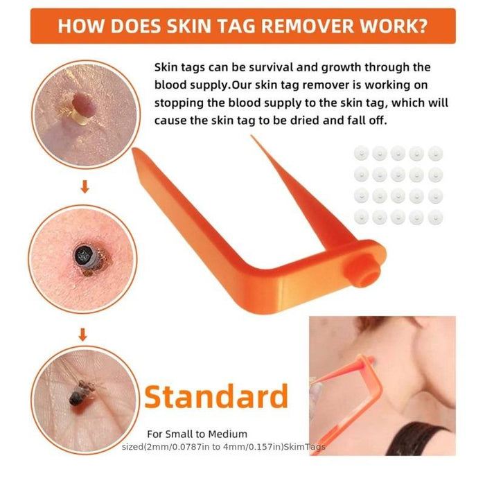 Painless Safe Skin Tag Remove Device Kit Micro Tags Size (2mm to 4mm) Warts Remover Original Skin Band Tool Set